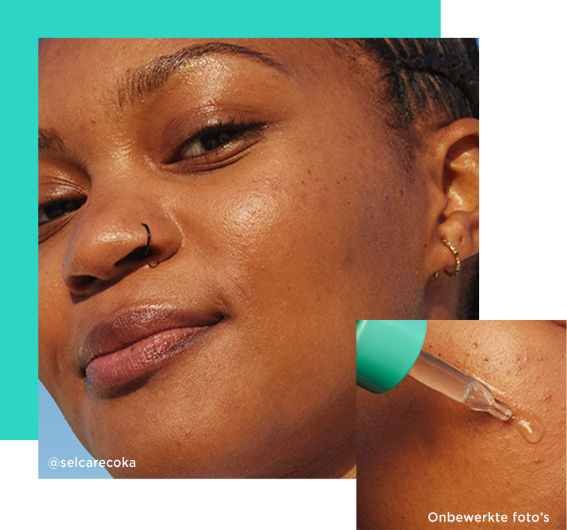 Turquoise achtergrond, Model vette huid, Textuur op de huid: serum